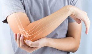 Physiotherapy for tennis elbow