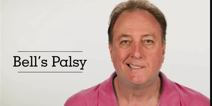 Physiotherapy treatment for bells palsy