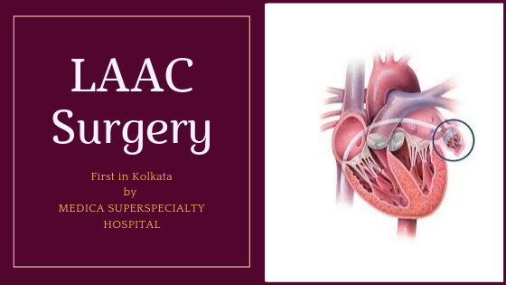 LAAC surgery kolkata