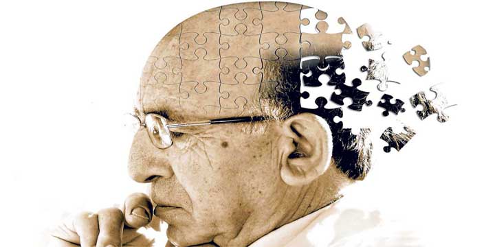 Stroke causes dementia